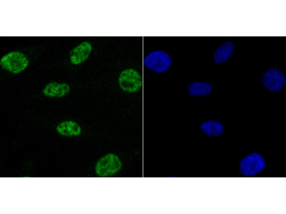 ICC staining of NRF1 in SH-SY5Y cells (green). Formalin fixed cells were permeabilized with 0.1% Triton X-100 in TBS for 10 minutes at room temperature and blocked with 1% Blocker BSA for 15 minutes at room temperature. Cells were probed with the primary antibody (ET1705-86, 1/50) for 1 hour at room temperature, washed with PBS. Alexa Fluor®488 Goat anti-Rabbit IgG was used as the secondary antibody at 1/1,000 dilution. The nuclear counter stain is DAPI (blue).