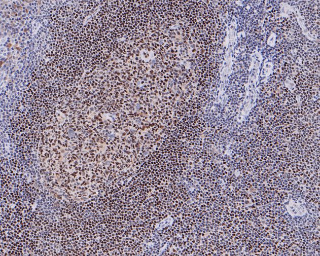 Immunohistochemical analysis of paraffin-embedded human tonsil tissue using anti-NRF1 antibody. The section was pre-treated using heat mediated antigen retrieval with sodium citrate buffer (pH 6.0) for 20 minutes. The tissues were blocked in 5% BSA for 30 minutes at room temperature, washed with ddH2O and PBS, and then probed with the primary antibody (ET1705-86, 1/200)  for 30 minutes at room temperature. The detection was performed using an HRP conjugated compact polymer system. DAB was used as the chromogen. Tissues were counterstained with hematoxylin and mounted with DPX.