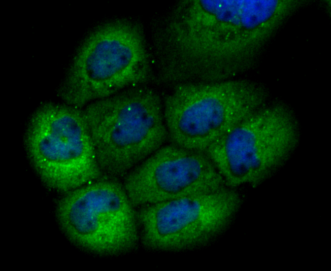 ICC staining of GCLM in A431 cells (green). Formalin fixed cells were permeabilized with 0.1% Triton X-100 in TBS for 10 minutes at room temperature and blocked with 1% Blocker BSA for 15 minutes at room temperature. Cells were probed with the primary antibody (ET1705-87, 1/50) for 1 hour at room temperature, washed with PBS. Alexa Fluor®488 Goat anti-Rabbit IgG was used as the secondary antibody at 1/1,000 dilution. The nuclear counter stain is DAPI (blue).