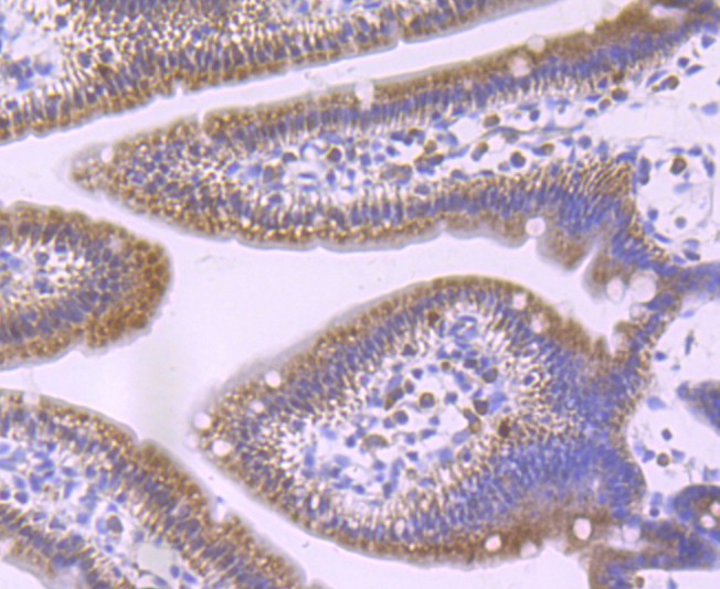 Immunohistochemical analysis of paraffin-embedded mouse small intestine tissue using anti-GCLM antibody. The section was pre-treated using heat mediated antigen retrieval with Tris-EDTA buffer (pH 8.0-8.4) for 20 minutes.The tissues were blocked in 5% BSA for 30 minutes at room temperature, washed with ddH2O and PBS, and then probed with the primary antibody (ET1705-87, 1/50) for 30 minutes at room temperature. The detection was performed using an HRP conjugated compact polymer system. DAB was used as the chromogen. Tissues were counterstained with hematoxylin and mounted with DPX.