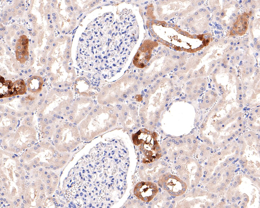 Immunohistochemical analysis of paraffin-embedded mouse kidney tissue with Rabbit anti-Klotho antibody (ET1705-88) at 1/100 dilution.<br />
<br />
The section was pre-treated using heat mediated antigen retrieval with Tris-EDTA buffer (pH 9.0) for 20 minutes. The tissues were blocked in 1% BSA for 20 minutes at room temperature, washed with ddH2O and PBS, and then probed with the primary antibody (ET1705-88) at 1/100 dilution for 1 hour at room temperature. The detection was performed using an HRP conjugated compact polymer system. DAB was used as the chromogen. Tissues were counterstained with hematoxylin and mounted with DPX.