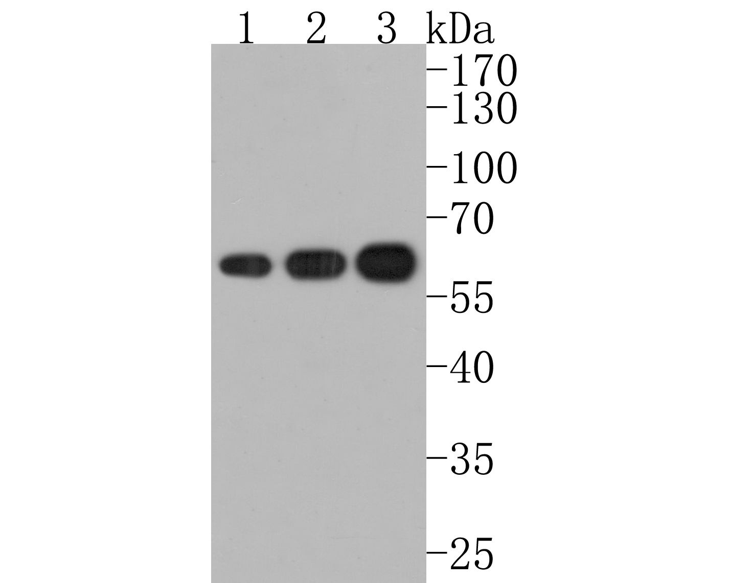 Western blot analysis of FTO on different lysates. Proteins were transferred to a PVDF membrane and blocked with 5% BSA in PBS for 1 hour at room temperature. The primary antibody (ET1705-89, 1/500) was used in 5% BSA at room temperature for 2 hours. Goat Anti-Rabbit IgG - HRP Secondary Antibody (HA1001) at 1:200,000 dilution was used for 1 hour at room temperature.<br />
Positive control: <br />
Lane 1: HepG2 cell lysate<br />
Lane 2: 293 cell lysate<br />
Lane 3: Human brain tissue lysate