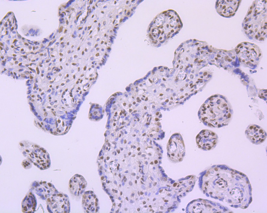 Immunohistochemical analysis of paraffin-embedded human placenta tissue using anti-FTO antibody. The section was pre-treated using heat mediated antigen retrieval with sodium citrate buffer (pH 6.0) for 20 minutes. The tissues were blocked in 1% BSA for 30 minutes at room temperature, washed with ddH2O and PBS, and then probed with the primary antibody (ET1705-89, 1/200)  for 30 minutes at room temperature. The detection was performed using an HRP conjugated compact polymer system. DAB was used as the chromogen. Tissues were counterstained with hematoxylin and mounted with DPX.
