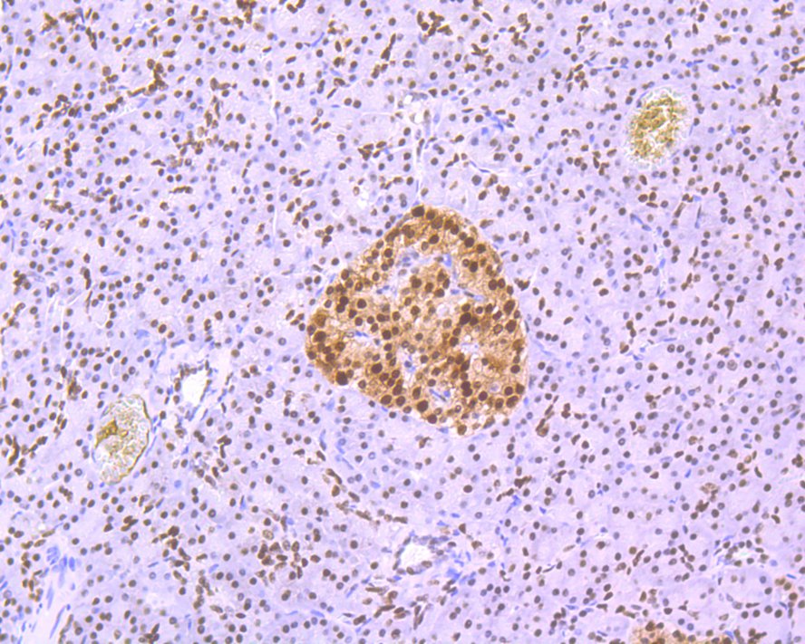 Immunohistochemical analysis of paraffin-embedded human pancreas tissue using anti-FTO antibody. The section was pre-treated using heat mediated antigen retrieval with sodium citrate buffer (pH 6.0) for 20 minutes. The tissues were blocked in 1% BSA for 30 minutes at room temperature, washed with ddH2O and PBS, and then probed with the primary antibody (ET1705-89, 1/200)  for 30 minutes at room temperature. The detection was performed using an HRP conjugated compact polymer system. DAB was used as the chromogen. Tissues were counterstained with hematoxylin and mounted with DPX.