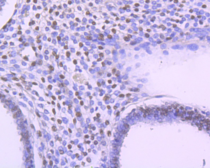 Immunohistochemical analysis of paraffin-embedded human uterus tissue using anti-FTO antibody. The section was pre-treated using heat mediated antigen retrieval with sodium citrate buffer (pH 6.0) for 20 minutes. The tissues were blocked in 1% BSA for 30 minutes at room temperature, washed with ddH2O and PBS, and then probed with the primary antibody (ET1705-89, 1/200)  for 30 minutes at room temperature. The detection was performed using an HRP conjugated compact polymer system. DAB was used as the chromogen. Tissues were counterstained with hematoxylin and mounted with DPX.