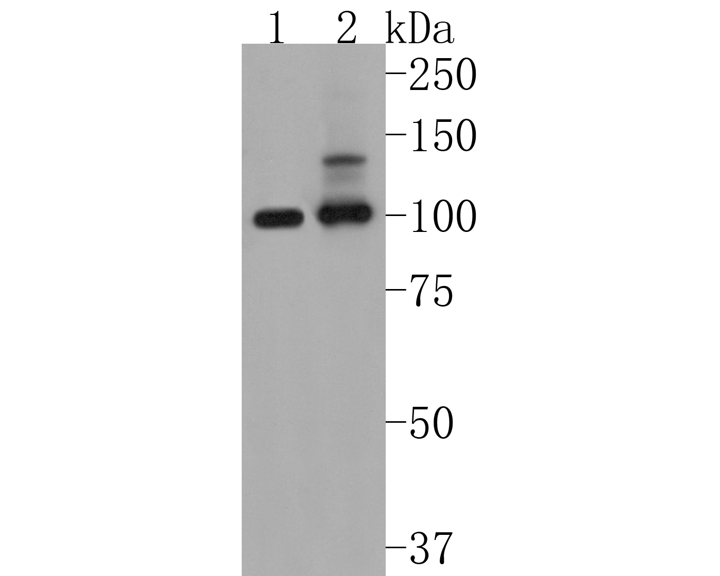 Western blot analysis of PSD93 on different lysates. Proteins were transferred to a PVDF membrane and blocked with 5% BSA in PBS for 1 hour at room temperature. The primary antibody (ET1705-90, 1/500) was used in 5% BSA at room temperature for 2 hours. Goat Anti-Rabbit IgG - HRP Secondary Antibody (HA1001) at 1:5,000 dilution was used for 1 hour at room temperature.<br />
Positive control: <br />
Lane 1: Hela cell lysate<br />
Lane 2: SH-SY5Y cell lysate