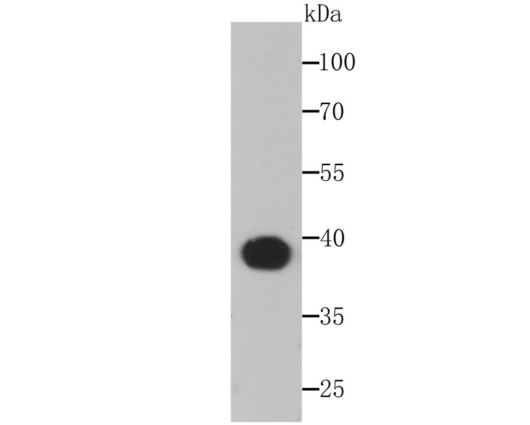Western blot analysis of Aldolase on zebrafish tissue lysates. Proteins were transferred to a PVDF membrane and blocked with 5% BSA in PBS for 1 hour at room temperature. The primary antibody (ET1705-91, 1/500) was used in 5% BSA at room temperature for 2 hours. Goat Anti-Rabbit IgG - HRP Secondary Antibody (HA1001) at 1:200,000 dilution was used for 1 hour at room temperature.