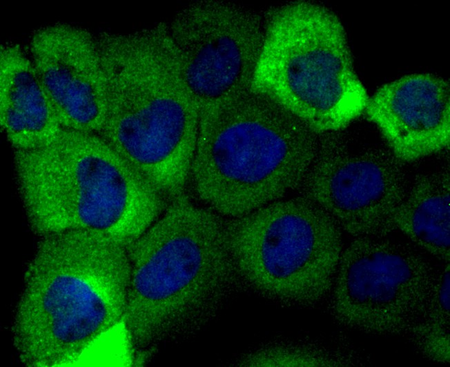 ICC staining of Aldolase in A431 cells (green). Formalin fixed cells were permeabilized with 0.1% Triton X-100 in TBS for 10 minutes at room temperature and blocked with 1% Blocker BSA for 15 minutes at room temperature. Cells were probed with the primary antibody (ET1705-91, 1/50) for 1 hour at room temperature, washed with PBS. Alexa Fluor®488 Goat anti-Rabbit IgG was used as the secondary antibody at 1/1,000 dilution. The nuclear counter stain is DAPI (blue).