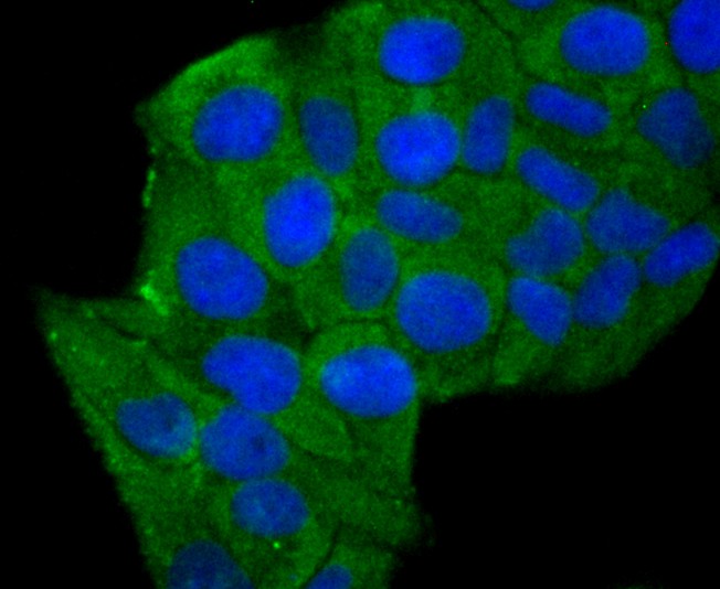 ICC staining of Aldolase in Hela cells (green). Formalin fixed cells were permeabilized with 0.1% Triton X-100 in TBS for 10 minutes at room temperature and blocked with 1% Blocker BSA for 15 minutes at room temperature. Cells were probed with the primary antibody (ET1705-91, 1/50) for 1 hour at room temperature, washed with PBS. Alexa Fluor®488 Goat anti-Rabbit IgG was used as the secondary antibody at 1/1,000 dilution. The nuclear counter stain is DAPI (blue).