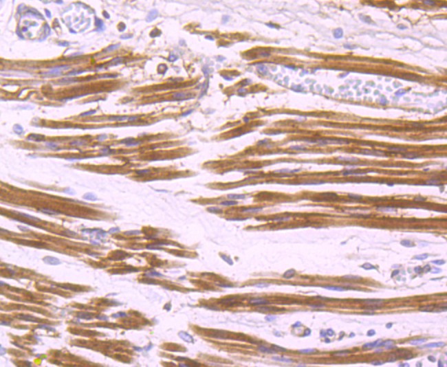 Immunohistochemical analysis of paraffin-embedded human fetal skeletal muscle tissue using anti-Aldolase antibody. The section was pre-treated using heat mediated antigen retrieval with Tris-EDTA buffer (pH 8.0-8.4) for 20 minutes.The tissues were blocked in 5% BSA for 30 minutes at room temperature, washed with ddH2O and PBS, and then probed with the primary antibody (ET1705-91, 1/50) for 30 minutes at room temperature. The detection was performed using an HRP conjugated compact polymer system. DAB was used as the chromogen. Tissues were counterstained with hematoxylin and mounted with DPX.