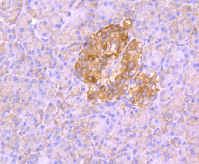 Immunohistochemical analysis of paraffin-embedded human pancreas tissue using anti-Aldolase antibody. The section was pre-treated using heat mediated antigen retrieval with Tris-EDTA buffer (pH 8.0-8.4) for 20 minutes.The tissues were blocked in 5% BSA for 30 minutes at room temperature, washed with ddH2O and PBS, and then probed with the primary antibody (ET1705-91, 1/50) for 30 minutes at room temperature. The detection was performed using an HRP conjugated compact polymer system. DAB was used as the chromogen. Tissues were counterstained with hematoxylin and mounted with DPX.