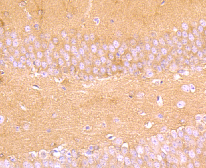 Immunohistochemical analysis of paraffin-embedded mouse brain tissue using anti-Aldolase antibody. The section was pre-treated using heat mediated antigen retrieval with Tris-EDTA buffer (pH 8.0-8.4) for 20 minutes.The tissues were blocked in 5% BSA for 30 minutes at room temperature, washed with ddH2O and PBS, and then probed with the primary antibody (ET1705-91, 1/50) for 30 minutes at room temperature. The detection was performed using an HRP conjugated compact polymer system. DAB was used as the chromogen. Tissues were counterstained with hematoxylin and mounted with DPX.