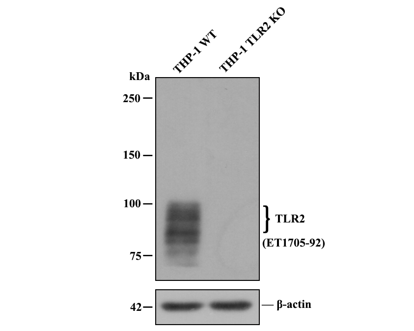 All lanes: Western blot analysis of TLR2 with anti-TLR2 antibody [JM22-41] (ET1705-92) at 1:500 dilution.<br />
Lane 1: Wild-type THP-1 whole cell lysate.<br />
Lane 2: TLR2 knockout THP-1 whole cell lysate.<br />
<br />
ET1705-92 was shown to specifically react with TLR2 in wild-type THP-1 cells. No band was observed when TLR2 knockout samples were tested. Wild-type and TLR2 knockout samples were subjected to SDS-PAGE. Proteins were transferred to a PVDF membrane and blocked with 5% NFDM in TBST for 1 hour at room temperature. The primary Anti-TLR2 antibody (ET1705-92, 1/500) and Anti-β-actin antibody (R1207-1, 1/1,000) were used in 5% BSA at room temperature for 2 hours. Goat Anti-Rabbit IgG H&L (HRP) Secondary Antibody (HA1001) at 1:200,000 dilution was used for 1 hour at room temperature.