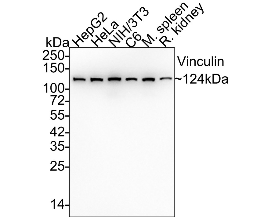 Western blot analysis of Vinculin on different lysates. Proteins were transferred to a PVDF membrane and blocked with 5% BSA in PBS for 1 hour at room temperature. The primary antibody (ET1705-94, 1/500) was used in 5% BSA at room temperature for 2 hours. Goat Anti-Rabbit IgG - HRP Secondary Antibody (HA1001) at 1:5,000 dilution was used for 1 hour at room temperature.<br />
Positive control: <br />
Lane 1: HepG2 cell lysate<br />
Lane 2: human skeletal muscle tissue lysate<br />
Lane 3: rat spleen tissue lysate<br />
Lane 4: mouse kidney tissue lysate