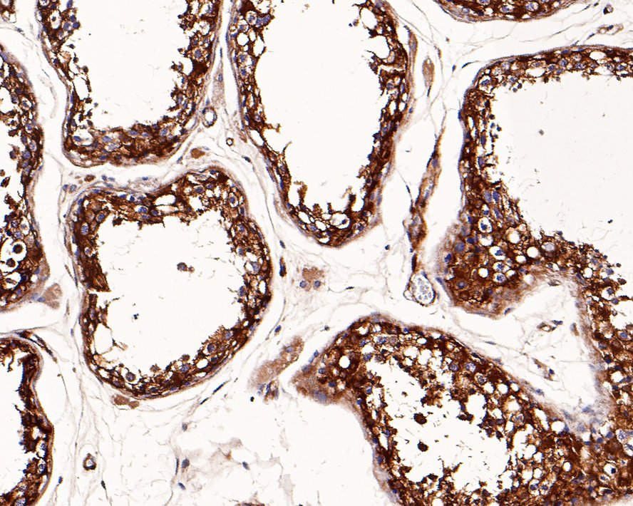 ICC staining of Vinculin in HUVEC cells (green). Formalin fixed cells were permeabilized with 0.1% Triton X-100 in TBS for 10 minutes at room temperature and blocked with 1% Blocker BSA for 15 minutes at room temperature. Cells were probed with the primary antibody (ET1705-94, 1/50) for 1 hour at room temperature, washed with PBS. Alexa Fluor®488 Goat anti-Rabbit IgG was used as the secondary antibody at 1/1,000 dilution. The nuclear counter stain is DAPI (blue).