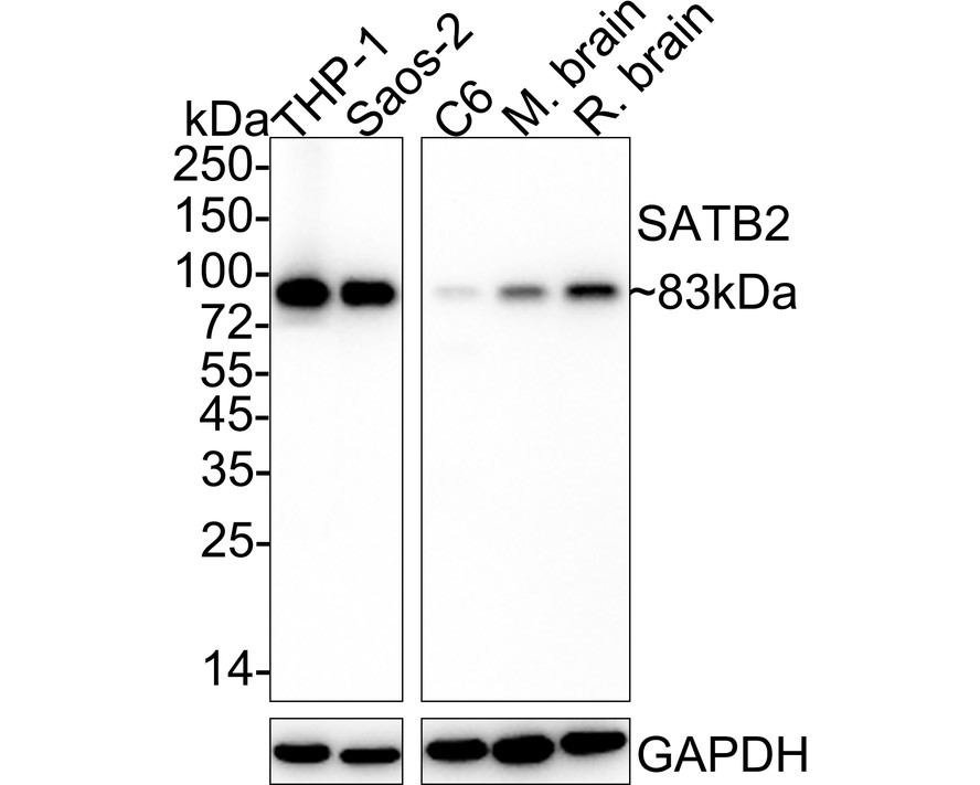 Western blot analysis of SATB2 on different lysates with Rabbit anti-SATB2 antibody (ET1705-95) at 1/1,000 dilution.<br />
<br />
Lane 1: THP-1 cell lysate<br />
Lane 2: K562 cell lysate<br />
<br />
Lysates/proteins at 10 µg/Lane.<br />
<br />
Predicted band size: 83 kDa<br />
Observed band size: 83 kDa<br />
<br />
Exposure time: 2 minutes;<br />
<br />
8% SDS-PAGE gel.<br />
<br />
Proteins were transferred to a PVDF membrane and blocked with 5% NFDM/TBST for 1 hour at room temperature. The primary antibody (ET1705-95) at 1/1,000 dilution was used in 5% NFDM/TBST at room temperature for 2 hours. Goat Anti-Rabbit IgG - HRP Secondary Antibody (HA1001) at 1:300,000 dilution was used for 1 hour at room temperature.