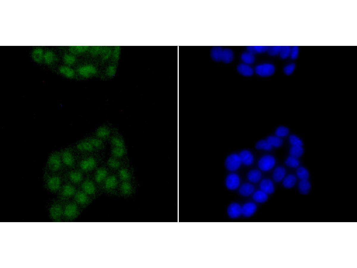 ICC staining of SATB2 in PC-12 cells (green). Formalin fixed cells were permeabilized with 0.1% Triton X-100 in TBS for 10 minutes at room temperature and blocked with 1% Blocker BSA for 15 minutes at room temperature. Cells were probed with the primary antibody (ET1705-95, 1/50) for 1 hour at room temperature, washed with PBS. Alexa Fluor®488 Goat anti-Rabbit IgG was used as the secondary antibody at 1/1,000 dilution. The nuclear counter stain is DAPI (blue).