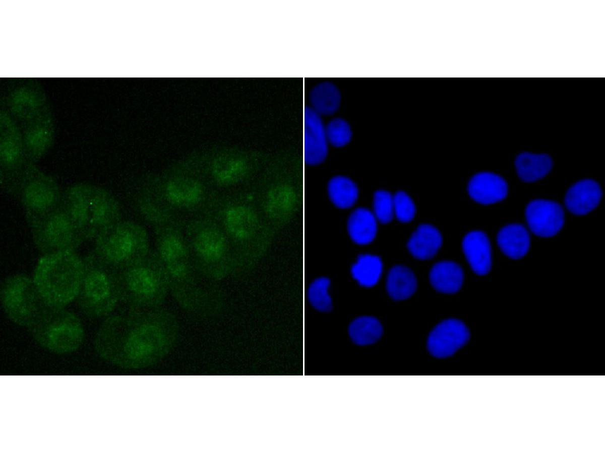 ICC staining of SATB2 in LOVO cells (green). Formalin fixed cells were permeabilized with 0.1% Triton X-100 in TBS for 10 minutes at room temperature and blocked with 1% Blocker BSA for 15 minutes at room temperature. Cells were probed with the primary antibody (ET1705-95, 1/50) for 1 hour at room temperature, washed with PBS. Alexa Fluor®488 Goat anti-Rabbit IgG was used as the secondary antibody at 1/1,000 dilution. The nuclear counter stain is DAPI (blue).