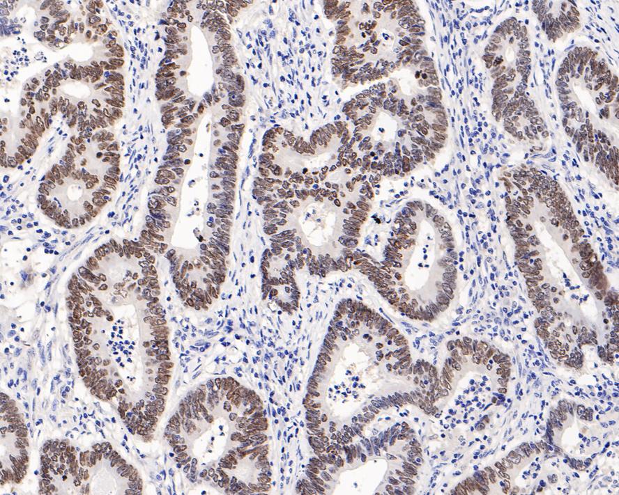 Immunohistochemical analysis of paraffin-embedded rat brain tissue using anti-SATB2 antibody. The section was pre-treated using heat mediated antigen retrieval with Tris-EDTA buffer (pH 8.0-8.4) for 20 minutes.The tissues were blocked in 5% BSA for 30 minutes at room temperature, washed with ddH2O and PBS, and then probed with the primary antibody (ET1705-95, 1/50) for 30 minutes at room temperature. The detection was performed using an HRP conjugated compact polymer system. DAB was used as the chromogen. Tissues were counterstained with hematoxylin and mounted with DPX.