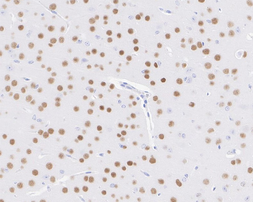 Immunohistochemical analysis of paraffin-embedded rat large intestine tissue with Rabbit anti-SATB2 antibody (ET1705-95) at 1/1,000 dilution.<br />
<br />
The section was pre-treated using heat mediated antigen retrieval with sodium citrate buffer (pH 6.0) for 2 minutes. The tissues were blocked in 1% BSA for 20 minutes at room temperature, washed with ddH2O and PBS, and then probed with the primary antibody (ET1705-95) at 1/1,000 dilution for 1 hour at room temperature. The detection was performed using an HRP conjugated compact polymer system. DAB was used as the chromogen. Tissues were counterstained with hematoxylin and mounted with DPX.