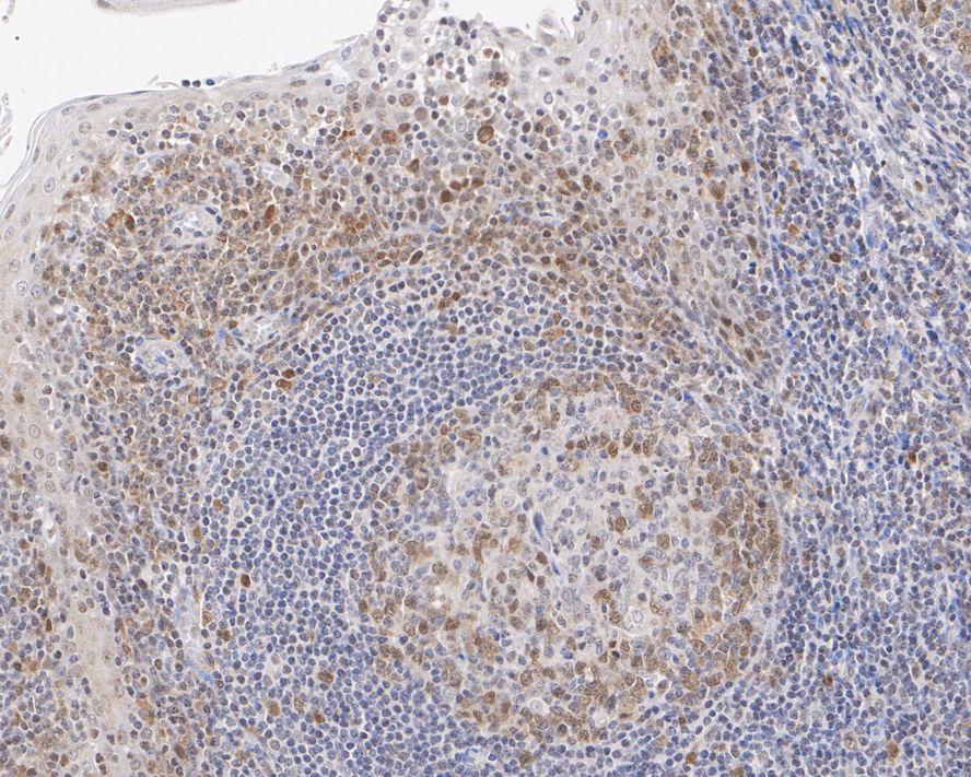 Immunohistochemical analysis of paraffin-embedded mouse testis tissue with Rabbit anti-Rad51 antibody (ET1705-96) at 1/1,000 dilution.<br />
<br />
The section was pre-treated using heat mediated antigen retrieval with sodium citrate buffer (pH 6.0) for 2 minutes. The tissues were blocked in 1% BSA for 20 minutes at room temperature, washed with ddH2O and PBS, and then probed with the primary antibody (ET1705-96) at 1/1,000 dilution for 1 hour at room temperature. The detection was performed using an HRP conjugated compact polymer system. DAB was used as the chromogen. Tissues were counterstained with hematoxylin and mounted with DPX.
