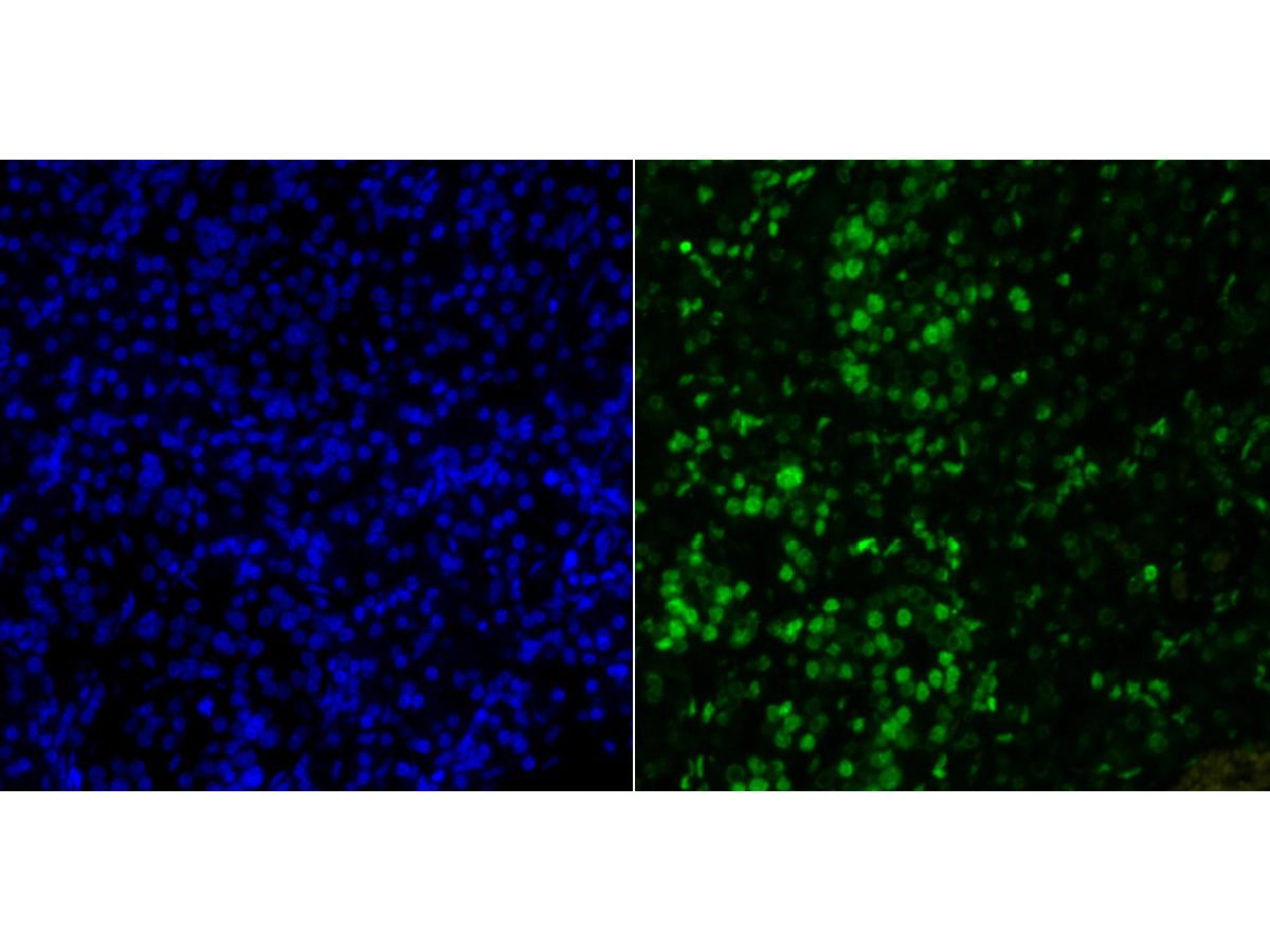 Immunofluorescence staining of paraffin- embedded human pancreas tissue using anti-Histone H2A.X antibody.The section was pre-treated using heat mediated antigen retrieval with Tris-EDTA buffer (pH 9.0) for 20 minutes. The tissues were blocked in 10% negative goat serum for 1 hour at room temperature, washed with PBS, and then probed with ET1705-97 at 1/50 dilution for 10 hours at 4℃ and detected using Alexa Fluor® 488 conjugate-Goat anti-Rabbit IgG (H+L) Secondary Antibody at a dilution of 1:500 for 1 hour at room temperature.