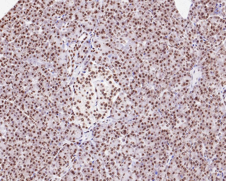 Immunohistochemical analysis of paraffin-embedded human pancreas tissue with Rabbit anti-Histone H2A.X antibody (ET1705-97) at 1/1,000 dilution.<br />
<br />
The section was pre-treated using heat mediated antigen retrieval with sodium citrate buffer (pH 6.0) for 2 minutes. The tissues were blocked in 1% BSA for 20 minutes at room temperature, washed with ddH2O and PBS, and then probed with the primary antibody (ET1705-97) at 1/1,000 dilution for 1 hour at room temperature. The detection was performed using an HRP conjugated compact polymer system. DAB was used as the chromogen. Tissues were counterstained with hematoxylin and mounted with DPX.