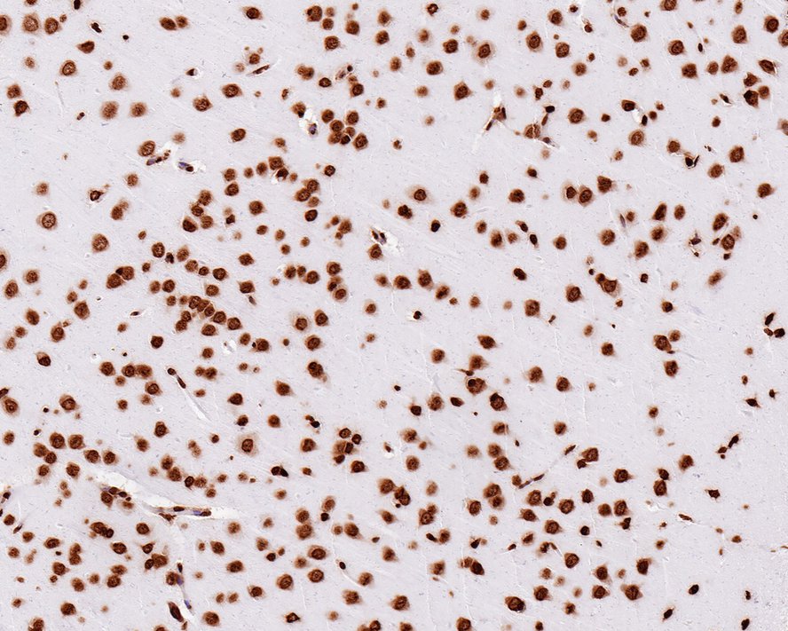 Immunohistochemical analysis of paraffin-embedded rat brain tissue with Rabbit anti-Histone H2A.X antibody (ET1705-97) at 1/1,000 dilution.<br />
<br />
The section was pre-treated using heat mediated antigen retrieval with sodium citrate buffer (pH 6.0) for 2 minutes. The tissues were blocked in 1% BSA for 20 minutes at room temperature, washed with ddH2O and PBS, and then probed with the primary antibody (ET1705-97) at 1/1,000 dilution for 1 hour at room temperature. The detection was performed using an HRP conjugated compact polymer system. DAB was used as the chromogen. Tissues were counterstained with hematoxylin and mounted with DPX.