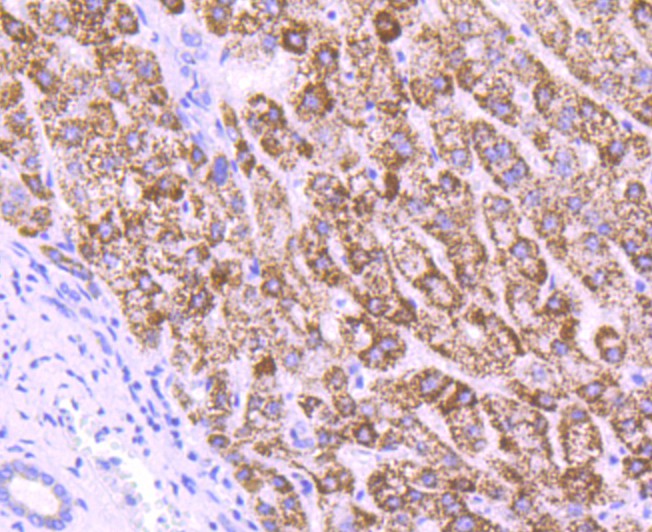Immunohistochemical analysis of paraffin-embedded human liver tissue using anti-MMP3 antibody. The section was pre-treated using heat mediated antigen retrieval with Tris-EDTA buffer (pH 8.0-8.4) for 20 minutes.The tissues were blocked in 5% BSA for 30 minutes at room temperature, washed with ddH2O and PBS, and then probed with the primary antibody (ET1705-98, 1/50) for 30 minutes at room temperature. The detection was performed using an HRP conjugated compact polymer system. DAB was used as the chromogen. Tissues were counterstained with hematoxylin and mounted with DPX.