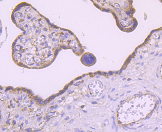 Immunohistochemical analysis of paraffin-embedded human placenta tissue using anti-MMP3 antibody. The section was pre-treated using heat mediated antigen retrieval with Tris-EDTA buffer (pH 8.0-8.4) for 20 minutes.The tissues were blocked in 5% BSA for 30 minutes at room temperature, washed with ddH2O and PBS, and then probed with the primary antibody (ET1705-98, 1/50) for 30 minutes at room temperature. The detection was performed using an HRP conjugated compact polymer system. DAB was used as the chromogen. Tissues were counterstained with hematoxylin and mounted with DPX.
