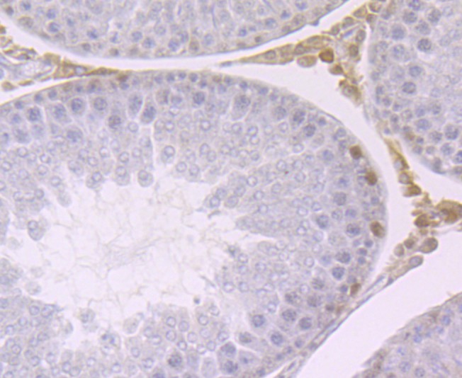 Immunohistochemical analysis of paraffin-embedded rat testis tissue using anti-HP1 gamma antibody. The section was pre-treated using heat mediated antigen retrieval with Tris-EDTA buffer (pH 8.0-8.4) for 20 minutes.The tissues were blocked in 5% BSA for 30 minutes at room temperature, washed with ddH2O and PBS, and then probed with the primary antibody (ET1706-02, 1/50) for 30 minutes at room temperature. The detection was performed using an HRP conjugated compact polymer system. DAB was used as the chromogen. Tissues were counterstained with hematoxylin and mounted with DPX.