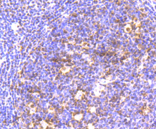Immunohistochemical analysis of paraffin-embedded human tonsil tissue using anti-HP1 gamma antibody. The section was pre-treated using heat mediated antigen retrieval with Tris-EDTA buffer (pH 8.0-8.4) for 20 minutes.The tissues were blocked in 5% BSA for 30 minutes at room temperature, washed with ddH2O and PBS, and then probed with the primary antibody (ET1706-02, 1/50) for 30 minutes at room temperature. The detection was performed using an HRP conjugated compact polymer system. DAB was used as the chromogen. Tissues were counterstained with hematoxylin and mounted with DPX.