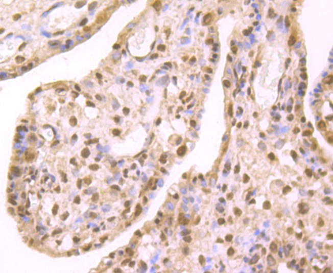 Immunohistochemical analysis of paraffin-embedded human placenta tissue using anti-HP1 gamma antibody. The section was pre-treated using heat mediated antigen retrieval with Tris-EDTA buffer (pH 8.0-8.4) for 20 minutes.The tissues were blocked in 5% BSA for 30 minutes at room temperature, washed with ddH2O and PBS, and then probed with the primary antibody (ET1706-02, 1/50) for 30 minutes at room temperature. The detection was performed using an HRP conjugated compact polymer system. DAB was used as the chromogen. Tissues were counterstained with hematoxylin and mounted with DPX.