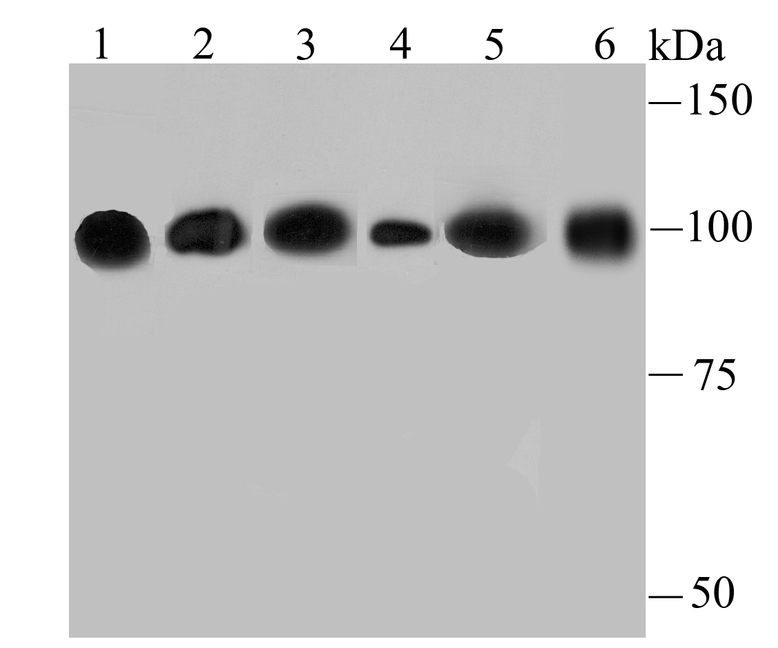 Immunocytochemistry analysis of A549 cells labeling alpha Actinin 4 with Rabbit anti-alpha Actinin 4 antibody (ET1706-05) at 1/50 dilution.<br />
<br />
Cells were fixed in 4% paraformaldehyde for 10 minutes at 37 ℃, permeabilized with 0.05% Triton X-100 in PBS for 20 minutes, and then blocked with 2% negative goat serum for 30 minutes at room temperature. Cells were then incubated with Rabbit anti-alpha Actinin 4 antibody (ET1706-05) at 1/50 dilution in 2% negative goat serum overnight at 4 ℃. Alexa Fluor®488 conjugate-Goat anti-Rabbit IgG was used as the secondary antibody at 1/1,000 dilution. Nuclear DNA was labelled in blue with DAPI.