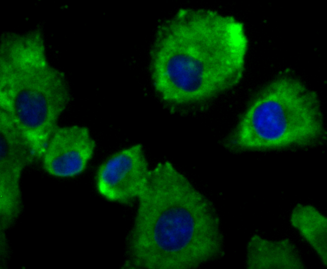 Immunocytochemistry analysis of Hela cells labeling alpha Actinin 4 with Rabbit anti-alpha Actinin 4 antibody (ET1706-05) at 1/50 dilution.<br />
<br />
Cells were fixed in 4% paraformaldehyde for 10 minutes at 37 ℃, permeabilized with 0.05% Triton X-100 in PBS for 20 minutes, and then blocked with 2% negative goat serum for 30 minutes at room temperature. Cells were then incubated with Rabbit anti-alpha Actinin 4 antibody (ET1706-05) at 1/50 dilution in 2% negative goat serum overnight at 4 ℃. Alexa Fluor®488 conjugate-Goat anti-Rabbit IgG was used as the secondary antibody at 1/1,000 dilution Nuclear DNA was labelled in blue with DAPI.
