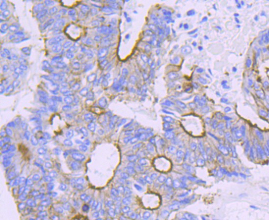 Immunohistochemical analysis of paraffin-embedded  mouse colon tissue with Rabbit anti-alpha Actinin 4 antibody (ET1706-05) at 1/50 dilution.<br />
<br />
The section was pre-treated using heat mediated antigen retrieval with Tris-EDTA buffer (pH 9.0) for 20 minutes. The tissues were blocked in 1% BSA for 20 minutes at room temperature, washed with ddH2O and PBS, and then probed with the primary antibody (ET1706-05) at 1/50 dilution for 0.5 hour at room temperature. The detection was performed using an HRP conjugated compact polymer system. DAB was used as the chromogen. Tissues were counterstained with hematoxylin and mounted with DPX.