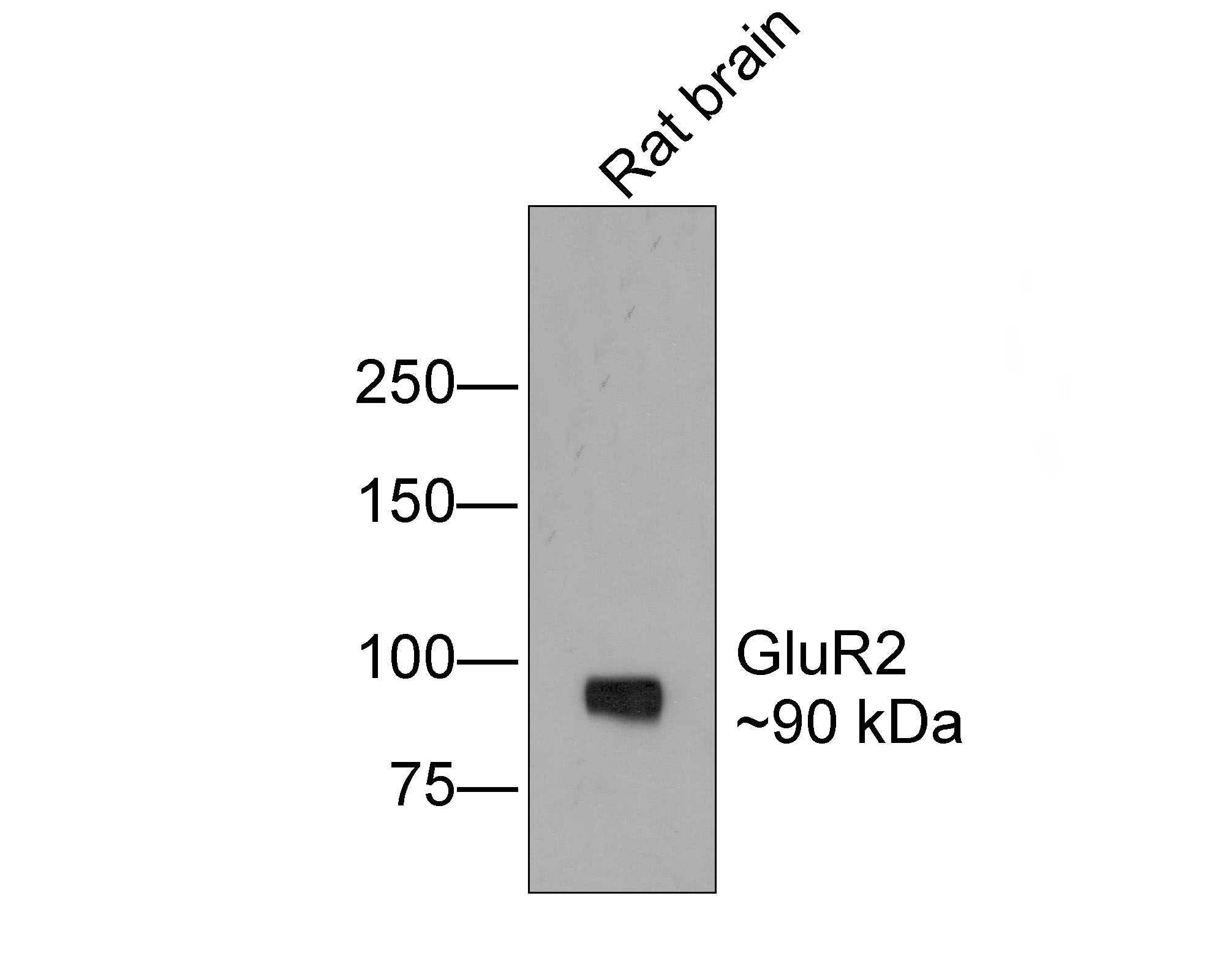 ICC staining of GluR2 in N2A cells (green). Formalin fixed cells were permeabilized with 0.1% Triton X-100 in TBS for 10 minutes at room temperature and blocked with 1% Blocker BSA for 15 minutes at room temperature. Cells were probed with the primary antibody (ET1706-06, 1/50) for 1 hour at room temperature, washed with PBS. Alexa Fluor®488 Goat anti-Rabbit IgG was used as the secondary antibody at 1/1,000 dilution. The nuclear counter stain is DAPI (blue).