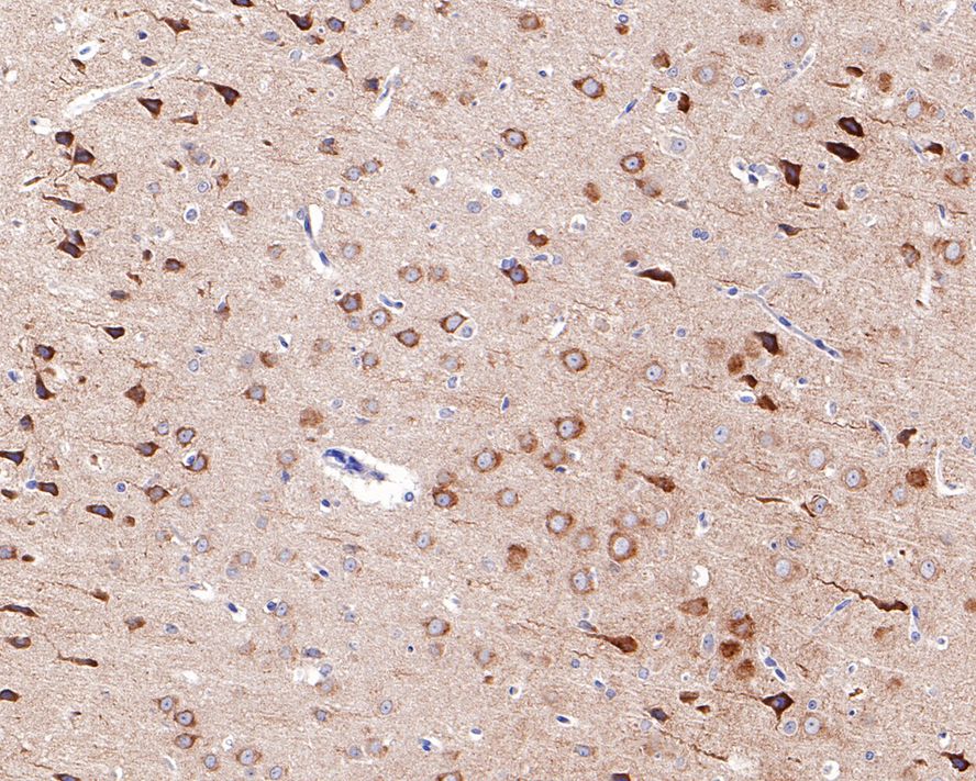 Immunohistochemical analysis of paraffin-embedded mouse brain tissue using anti-GluR2 antibody. The section was pre-treated using heat mediated antigen retrieval with Tris-EDTA buffer (pH 8.0-8.4) for 20 minutes.The tissues were blocked in 5% BSA for 30 minutes at room temperature, washed with ddH2O and PBS, and then probed with the primary antibody (ET1706-06, 1/50) for 30 minutes at room temperature. The detection was performed using an HRP conjugated compact polymer system. DAB was used as the chromogen. Tissues were counterstained with hematoxylin and mounted with DPX.