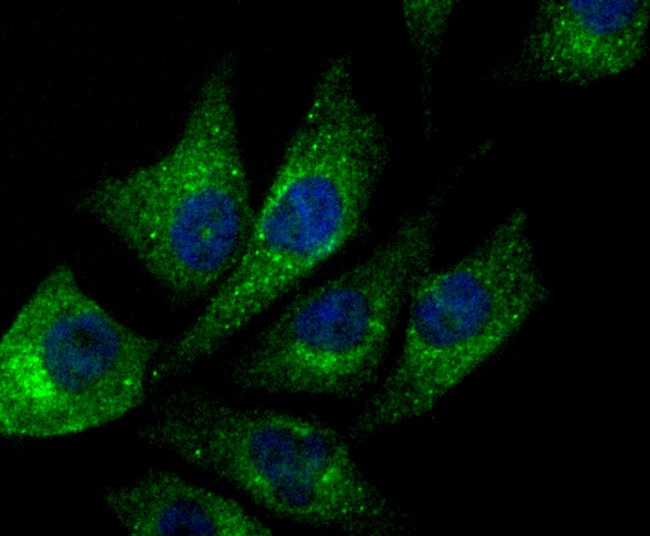 ICC staining of NDUFS3 in PC-3M cells (green). Formalin fixed cells were permeabilized with 0.1% Triton X-100 in TBS for 10 minutes at room temperature and blocked with 10% negative goat serum for 15 minutes at room temperature. Cells were probed with the primary antibody (ET1706-07, 1/50) for 1 hour at room temperature, washed with PBS. Alexa Fluor®488 conjugate-Goat anti-Rabbit IgG was used as the secondary antibody at 1/1,000 dilution. The nuclear counter stain is DAPI (blue).