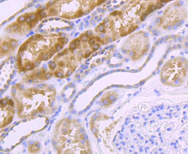 Immunohistochemical analysis of paraffin-embedded human kidney tissue using anti-NDUFS3 antibody. The section was pre-treated using heat mediated antigen retrieval with Tris-EDTA buffer (pH 9.0) for 20 minutes.The tissues were blocked in 1% BSA for 30 minutes at room temperature, washed with ddH2O and PBS, and then probed with the primary antibody (ET1706-07, 1/50) for 30 minutes at room temperature. The detection was performed using an HRP conjugated compact polymer system. DAB was used as the chromogen. Tissues were counterstained with hematoxylin and mounted with DPX.