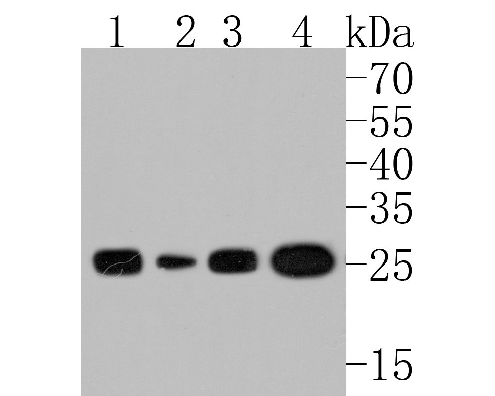 Western blot analysis of HPRT on different lysates with Rabbit anti-HPRT antibody (ET1706-08) at 1/500 dilution.<br />
<br />
Lane 1: rat kidney tissue lysate<br />
Lane 2: rat tonsil brain lysate<br />
Lane 3: mouse testis tissue lysate<br />
Lane 4: mouse colon tissue lysate<br />
<br />
Lysates/proteins at 20 µg/Lane.<br />
<br />
Predicted band size: 25 kDa<br />
Observed band size: 25 kDa<br />
<br />
Exposure time: 2 minutes;<br />
<br />
15% SDS-PAGE gel.<br />
<br />
Proteins were transferred to a PVDF membrane and blocked with 5% NFDM/TBST for 1 hour at room temperature. The primary antibody (ET1706-08) at 1/500 dilution was used in 5% NFDM/TBST at room temperature for 2 hours. Goat Anti-Rabbit IgG - HRP Secondary Antibody (HA1001) at 1:5,000 dilution was used for 1 hour at room temperature.