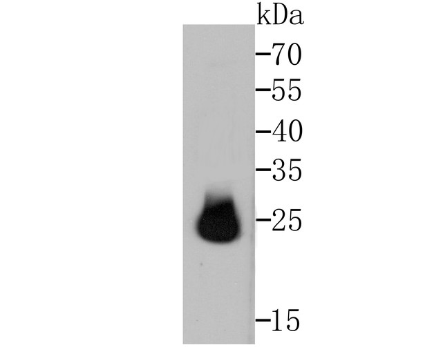 Western blot analysis of HPRT on zebrafish tissue lysates with Rabbit anti-HPRT antibody (ET1706-08) at 1/500 dilution.<br />
<br />
Lysates/proteins at 20 µg/Lane.<br />
<br />
Predicted band size: 25 kDa<br />
Observed band size: 25 kDa<br />
<br />
Exposure time: 2 minutes;<br />
<br />
15% SDS-PAGE gel.<br />
<br />
Proteins were transferred to a PVDF membrane and blocked with 5% NFDM/TBST for 1 hour at room temperature. The primary antibody (ET1706-08) at 1/500 dilution was used in 5% NFDM/TBST at room temperature for 2 hours. Goat Anti-Rabbit IgG - HRP Secondary Antibody (HA1001) at 1:200,000 dilution was used for 1 hour at room temperature.