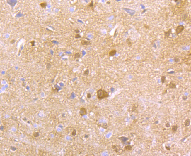 Immunohistochemical analysis of paraffin-embedded  rat brain tissue with Rabbit anti-HPRT antibody (ET1706-08) at 1/50 dilution.<br />
<br />
The section was pre-treated using heat mediated antigen retrieval with Tris-EDTA buffer (pH 8.0-8.4) for 20 minutes. The tissues were blocked in 1% BSA for 20 minutes at room temperature, washed with ddH2O and PBS, and then probed with the primary antibody (ET1706-08) at 1/50 dilution for 0.5 hour at room temperature. The detection was performed using an HRP conjugated compact polymer system. DAB was used as the chromogen. Tissues were counterstained with hematoxylin and mounted with DPX.