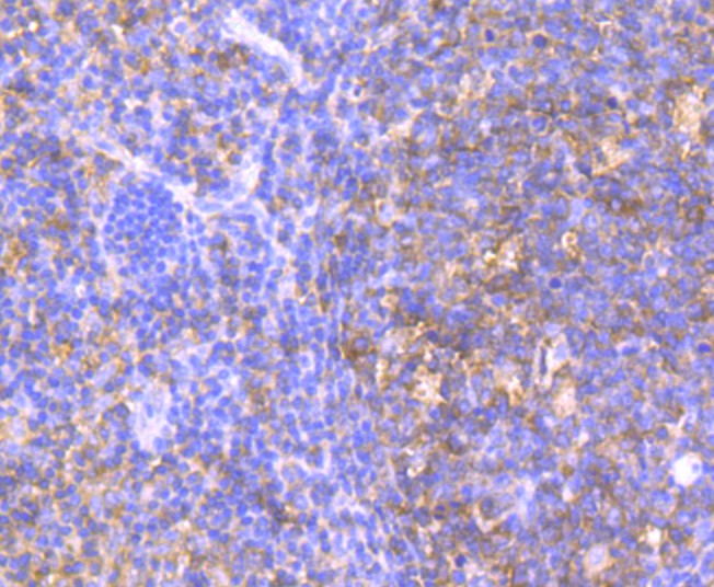 Immunohistochemical analysis of paraffin-embedded  human tonsil tissue with Rabbit anti-HPRT antibody (ET1706-08) at 1/50 dilution.<br />
<br />
The section was pre-treated using heat mediated antigen retrieval with Tris-EDTA buffer (pH 8.0-8.4) for 20 minutes. The tissues were blocked in 1% BSA for 20 minutes at room temperature, washed with ddH2O and PBS, and then probed with the primary antibody (ET1706-08) at 1/50 dilution for 0.5 hour at room temperature. The detection was performed using an HRP conjugated compact polymer system. DAB was used as the chromogen. Tissues were counterstained with hematoxylin and mounted with DPX.
