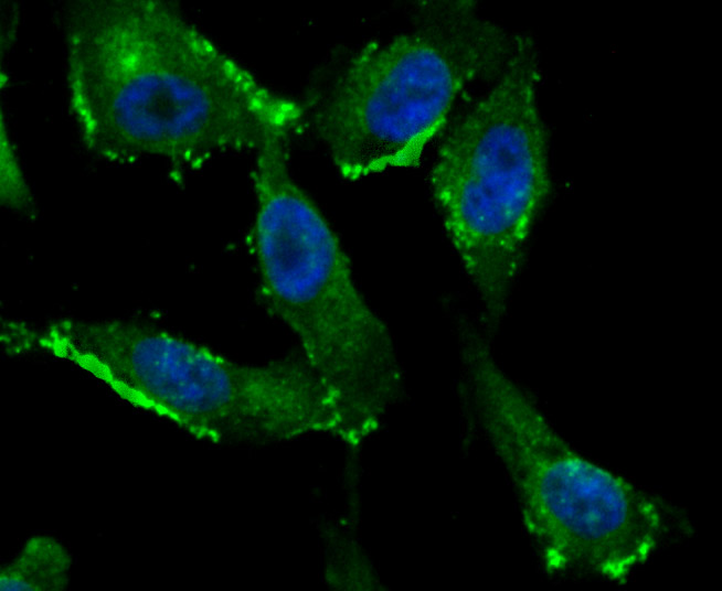 ICC staining of Fragilis in PC-3M cells (green). Formalin fixed cells were permeabilized with 0.1% Triton X-100 in TBS for 10 minutes at room temperature and blocked with 10% negative goat serum for 15 minutes at room temperature. Cells were probed with the primary antibody (ET1706-09, 1/50) for 1 hour at room temperature, washed with PBS. Alexa Fluor®488 Goat anti-Rabbit IgG was used as the secondary antibody at 1/1,000 dilution. The nuclear counter stain is DAPI (blue).