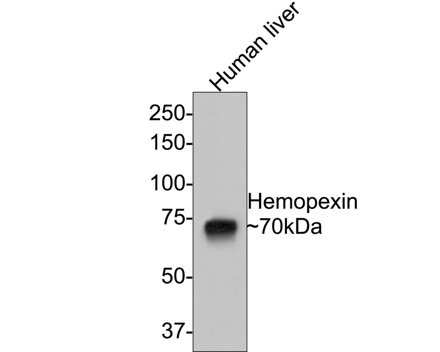 Western blot analysis of Hemopexin on human liver tissue lysates with Rabbit anti-Hemopexin antibody (ET1706-10) at 1/500 dilution.<br />
<br />
Lysates/proteins at 20 µg/Lane.<br />
<br />
Predicted band size: 52 kDa<br />
Observed band size: 70 kDa<br />
<br />
Exposure time: 2 minutes;<br />
<br />
8% SDS-PAGE gel.<br />
<br />
Proteins were transferred to a PVDF membrane and blocked with 5% NFDM/TBST for 1 hour at room temperature. The primary antibody (ET1706-10) at 1/500 dilution was used in 5% NFDM/TBST at room temperature for 2 hours. Goat Anti-Rabbit IgG - HRP Secondary Antibody (HA1001) at 1:300,000 dilution was used for 1 hour at room temperature.