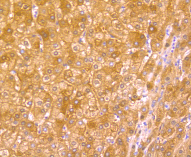 Immunohistochemical analysis of paraffin-embedded human liver tissue with Rabbit anti-Hemopexin antibody (ET1706-10) at 1/50 dilution.<br />
<br />
The section was pre-treated using heat mediated antigen retrieval with Tris-EDTA buffer (pH 9.0) for 20 minutes. The tissues were blocked in 1% BSA for 20 minutes at room temperature, washed with ddH2O and PBS, and then probed with the primary antibody (ET1706-10) at 1/50 dilution for 0.5 hour at room temperature. The detection was performed using an HRP conjugated compact polymer system. DAB was used as the chromogen. Tissues were counterstained with hematoxylin and mounted with DPX.
