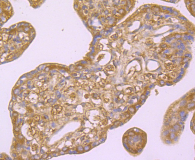 Immunohistochemical analysis of paraffin-embedded human placenta tissue with Rabbit anti-Hemopexin antibody (ET1706-10) at 1/50 dilution.<br />
<br />
The section was pre-treated using heat mediated antigen retrieval with Tris-EDTA buffer (pH 9.0) for 20 minutes. The tissues were blocked in 1% BSA for 20 minutes at room temperature, washed with ddH2O and PBS, and then probed with the primary antibody (ET1706-10) at 1/50 dilution for 0.5 hour at room temperature. The detection was performed using an HRP conjugated compact polymer system. DAB was used as the chromogen. Tissues were counterstained with hematoxylin and mounted with DPX.