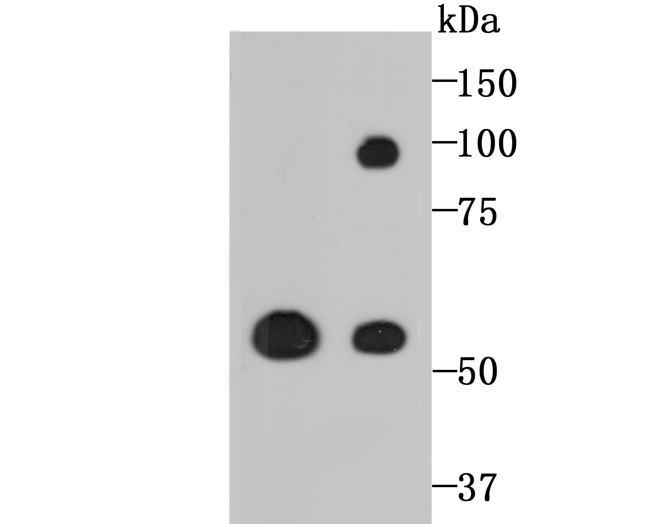 Western blot analysis of LOXL2 on different lysates with Rabbit anti-LOXL2 antibody (ET1706-11) at 1/500 dilution.<br />
<br />
Lane 1: PC-12 cell lysate, 10 µg/Lane<br />
Lane 2: A549 cell lysate, 10 µg/Lane<br />
<br />
Predicted band size: 87 kDa<br />
Observed band size: 59 kDa<br />
<br />
Exposure time: 2 minutes;<br />
<br />
10% SDS-PAGE gel.<br />
<br />
Proteins were transferred to a PVDF membrane and blocked with 5% NFDM/TBST for 1 hour at room temperature. The primary antibody (ET1706-11) at 1/500 dilution was used in 5% NFDM/TBST at room temperature for 2 hours. Goat Anti-Rabbit IgG - HRP Secondary Antibody (HA1001) at 1:200,000 dilution was used for 1 hour at room temperature.