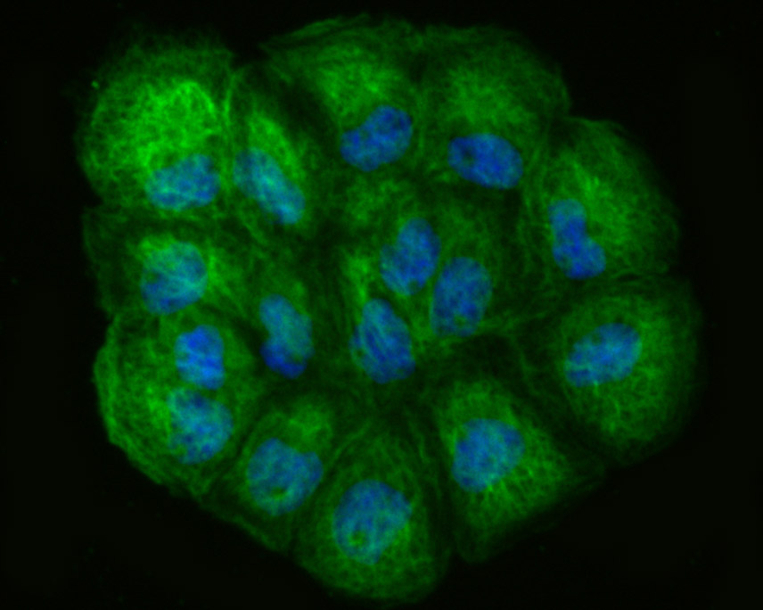 ICC staining of LOXL2 in A431 cells (green). Formalin fixed cells were permeabilized with 0.1% Triton X-100 in TBS for 10 minutes at room temperature and blocked with 10% negative goat serum for 15 minutes at room temperature. Cells were probed with the primary antibody (ET1706-11, 1/50) for 1 hour at room temperature, washed with PBS. Alexa Fluor®488 Goat anti-Rabbit IgG was used as the secondary antibody at 1/1,000 dilution. The nuclear counter stain is DAPI (blue).
